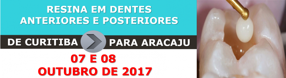 #display5 Vagas limitadas!